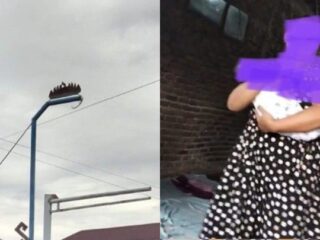 Peristiwa Nahas Menimpa Bayi Tak Berdosa, Jari Terpotong Saat Proses Persalinan